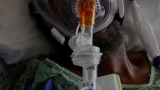 COVID raises risk of long-term brain injury, large U.S. study finds – Health