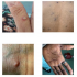 CDC plans for increase mokeypox cases following confirmed cases in Alabama