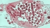 Maine CDC investigating after 4 hospitalized with Legionnaires' disease in Bangor area – WGME