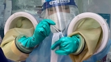 People who had COVID more at risk of developing pulmonary embolism, CDC says – WJAC Johnstown