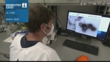 CDC now reports the US has one of the highest levels of monkeypox in the world