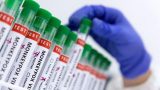 No monkeypox cases so far in India as three samples test -ve | Latest News India