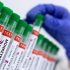 FDA, CDC investigating hepatitis A cases potentially linked to H-E-B organic strawberries | Local News
