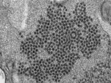 Expected surge in virus that can paralyze kids didn’t happen, baffling experts – Yahoo! Voices