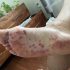 43% of parents won’t give COVID-19 vaccine to children under 5