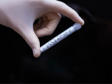 As rat-caused Lassa fever enters UK after a decade; know everything about the disease