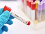 Coronavirus: Study finds risk of reinfection with Omicron is five times more than other variants; Are reinfections milder? How soon can you get reinfected?