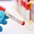 CDC data shows significant drop in new COVID cases in Florida