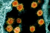 CDC reports 72 additional COVID-19 deaths in Oklahoma