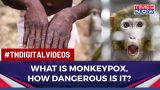 All About Monkeypox, How Dangerous Is Smallpox-Like Disease From Africa? | World News