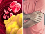 Two painful sensations to watch out for in your arm