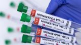 Monkeypox: Govt issues revised guidelines for int’l passengers | Latest News India