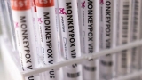 Africa in need of test kits, vaccines for monkeypox: CDC Africa