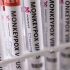 Michigan doesn’t have any doses of vaccine used to prevent monkeypox