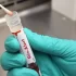 What treatments are there for COVID?