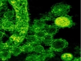 Health News | Study Shows New and More Detailed World Map of Antimicrobial Resistance
