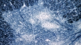 CDC launches initiative to test wastewater for polioviruses