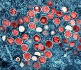 CDC confirms 18 monkeypox cases in Mississippi