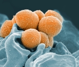 CDC issues warning about Strep A infections in children