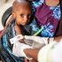 CDC confirms 17 monkeypox cases in Mississippi