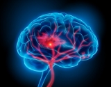 Researchers reveal why shingles can lead to stroke