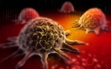 Metabolomics and the Microbiome of Breasts