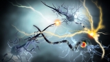 Whole blood exchange could offer disease-modifying therapy for Alzheimer’s disease