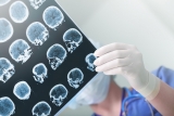Pioneering EEG test could dramatically increase early diagnosis of Alzheimer’s