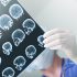 New CDC profile shares demographics of assisted living residents – News