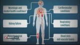 New CDC study shows 1 in 5 adults may suffer from long COVID symptoms