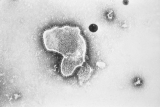 Here’s the main differences between COVID, RSV, a cold and the flu as cases rise