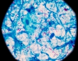 Shorter treatment for children with non-severe tuberculosis