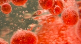 UWA hosts WHO expert working group for implementation of Patient Blood Management
