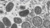 Cincinnati, Hamilton County leaders to discuss monkeypox vaccine availability