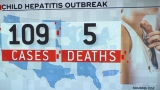 Watch CBS Evening News: CDC probes spread of hepatitis in children
