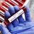 Salmonella Outbreak Reported In Oklahoma, Other States
