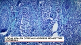 Local health officials address monkeypox outbreak