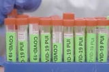 All But 1 of Illinois’ 102 Counties Seeing Low COVID Community Levels: CDC – NBC Chicago