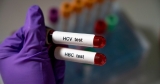 348 probable cases of acute hepatitis in children reported globally: WHO – National