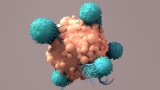 Cancer in people under 50 is rising around the world. Why?