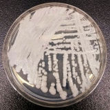 ‘Superbug’ linked to 63 deaths in Nevada