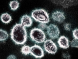 Synthetic virus could ‘parasitize’ SARS-CoV-2