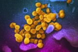 XBB COVID variant now dominant in the Northeast, according to CDC data