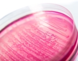 New update on CDC’s investigation of multistate outbreak of E. coli O157 infection