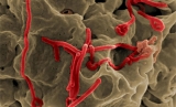 Ebola outbreak in Uganda, as of 2 November 2022