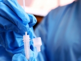 Is there a link between long COVID and Epstein-Barr virus?