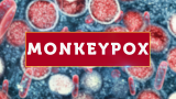 Riverside County reports 10 more monkeypox cases, total now 244