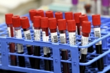 What is parechovirus? CDC issues advisory after infant death