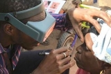 Gambia becomes 2nd African nation to eliminate trachoma, WHO says