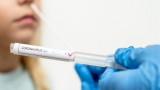 How Long Do COVID Symptoms Last? Here’s What We Know So Far – NBC Chicago